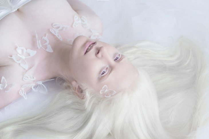Queste foto mostrano l’accattivante bellezza delle persone con albinismo
