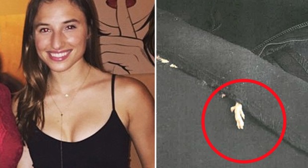 Una donna ha trovato un topo morto cucito nel vestito di Zara